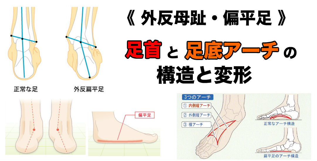 倉敷市で、なかなか腰痛が改善しない方、もしかして、外反母趾や偏平足ではないですか？